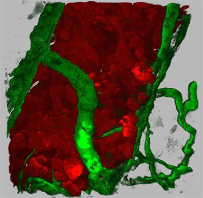 VEGF secreting human tumor cells inducing angiogenesis within the Zebrafish body wall. Tumor cells are shown in red (DsRed), fish blood vessels are shown in green (GFP). (Credit: UCSD School of Medicine) VEGF secreting human tumor cells inducing angiogenesis within the Zebrafish body wall. Tumor cells are shown in red (DsRed), fish blood vessels are shown in green (GFP). (Credit: UCSD School of Medicine)