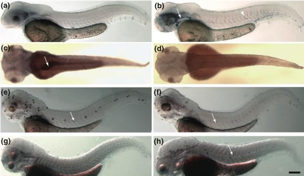 Zebrafish embryos were exposed to eleven common pollutants, including cadmium, mercury and arsenic. Scientists monitored changes in gene-expression profiles in order to predict the chemical that the embryo had been exposed to; the results were clear-cut for 10 out of 11 toxins. (Credit: Image courtesy of BioMed Central) Zebrafish embryos were exposed to eleven common pollutants, including cadmium, mercury and arsenic. Scientists monitored changes in gene-expression profiles in order to predict the chemical that the embryo had been exposed to; the results were clear-cut for 10 out of 11 toxins. (Credit: Image courtesy of BioMed Central)