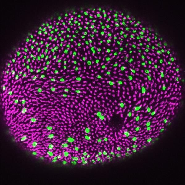 This fireworks display is actually a microscope image of a zebrafish retina immunolabeled for ultraviolet cones (magenta) and rods (green). The image shows the regular pattern of the cones and the scattered pattern of the rods typical of a normal fish. The labeling was performed by Karen Alverez-Delfin, doctoral candidate at Florida State University. (Credit: Florida State Associate Professor James Fadool and Alverez-Delfin) This fireworks display is actually a microscope image of a zebrafish retina immunolabeled for ultraviolet cones (magenta) and rods (green). The image shows the regular pattern of the cones and the scattered pattern of the rods typical of a normal fish. The labeling was performed by Karen Alverez-Delfin, doctoral candidate at Florida State University. (Credit: Florida State Associate Professor James Fadool and Alverez-Delfin)
