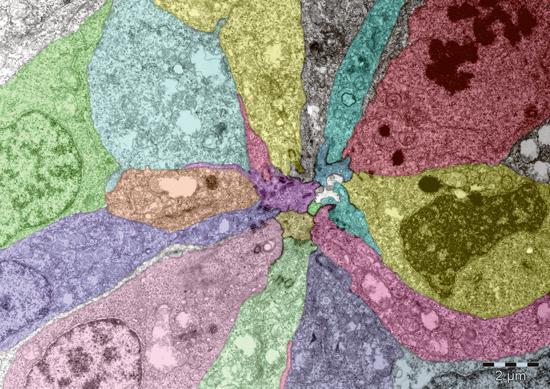 As a zebrafish embryo develops, the cells that will form its lateral line have to become pointed at one end and arrange themselves around a central, unchanged cell, forming a rosette. This microscopy image shows one such rosette, magnified approximately 10,000 times. (Credit: Virginie Lecaudey / EMBL)