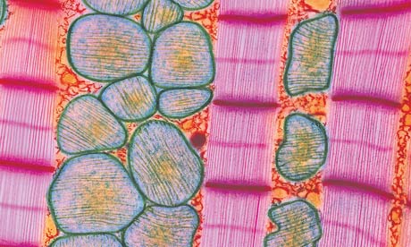 At University College, London, researchers led by Professor Paul Riley have managed to transform cells from the outer layer of the heart into heart muscle cells in mice. Photograph: Steve Gschmeissner/Science Photo Library At University College, London, researchers led by Professor Paul Riley have managed to transform cells from the outer layer of the heart into heart muscle cells in mice. Photograph: Steve Gschmeissner/Science Photo Library