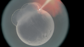 microinjection embryos